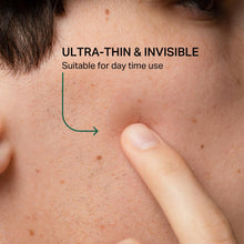 Acne Healing Patches