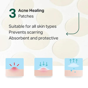 Essential 3-Step Acne Kit